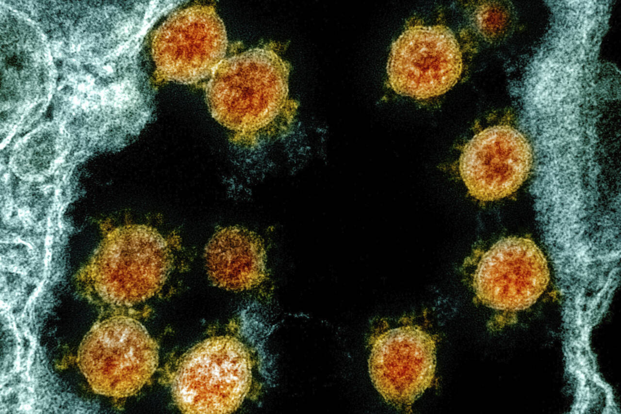 Partikler fra viruset SARS-CoV-2, som nå har smittet over 25 millioner mennesker verden over. Foto: AP / NTB scanpix