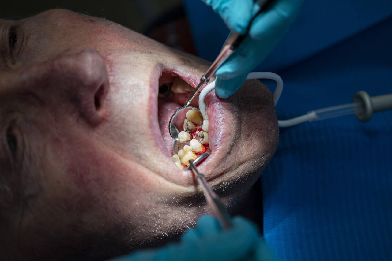 Ved god hygiene og jevnlige kontroller hos tannlege kan de fleste orale sykdommer i stor grad forebygges, og dermed også svært mange negative konsekvenser de kan få for resten av kroppen. Illustrasjonsfoto: Tore Meek / NTB